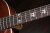 Inlays