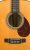 Soundhole