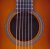 Soundhole